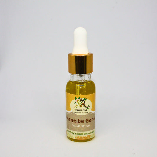 Glow Facial Serum (Acne be Gone)